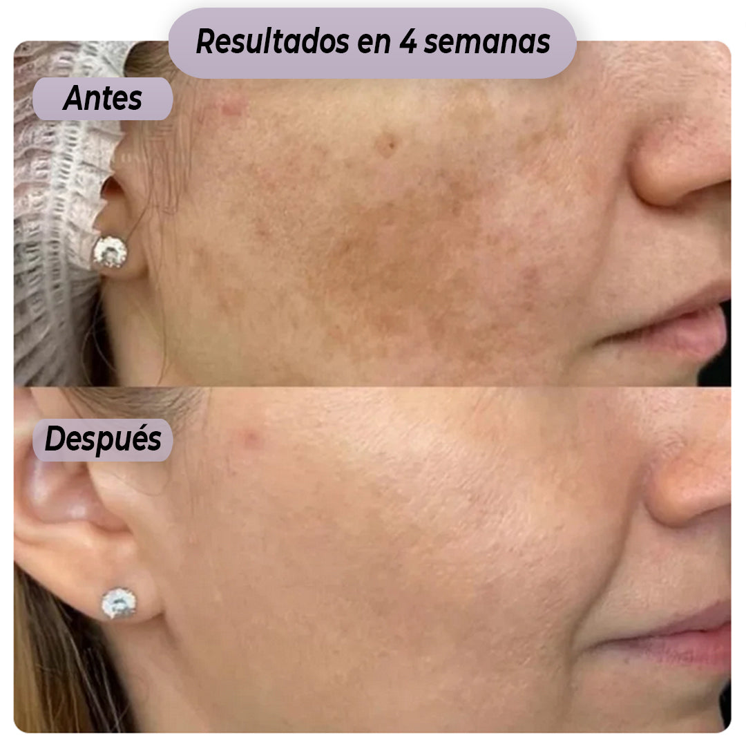 Lutinal™ - El Retinal de cuidado diario
